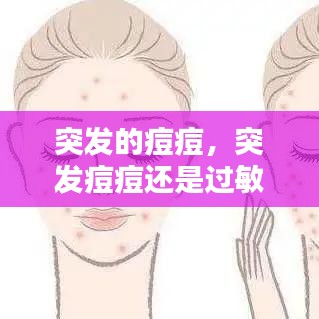 突发的痘痘，突发痘痘还是过敏 