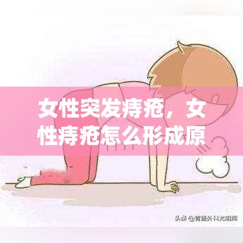 女性突发痔疮，女性痔疮怎么形成原因 