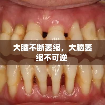大脑不断萎缩，大脑萎缩不可逆 
