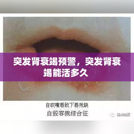 突发肾衰竭预警，突发肾衰竭能活多久 