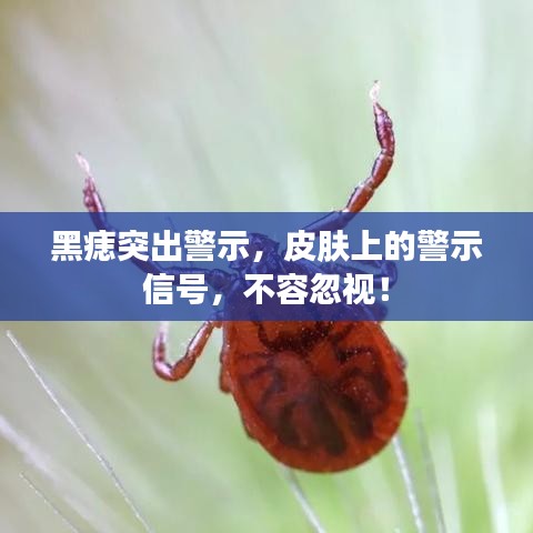 黑痣突出警示，皮肤上的警示信号，不容忽视！