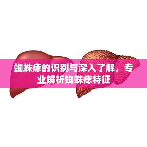 蜘蛛痣的识别与深入了解，专业解析蜘蛛痣特征
