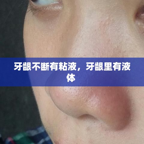牙龈不断有粘液，牙龈里有液体 