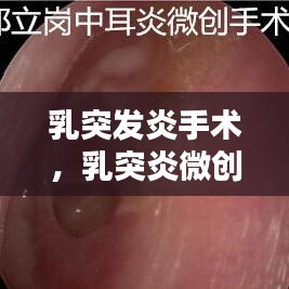 乳突发炎手术，乳突炎微创手术 