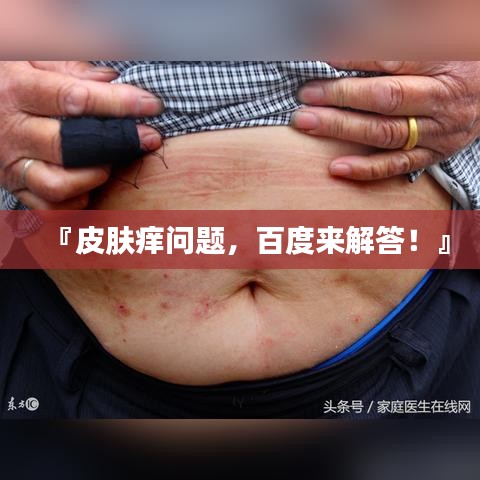 『皮肤痒问题，百度来解答！』