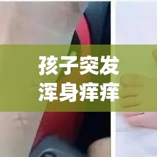 孩子突发浑身痒痒，家长如何应对及处理策略！